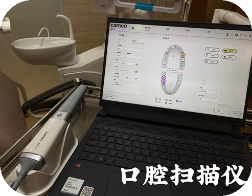 邢台地区牙齿贴面做的怎么样？