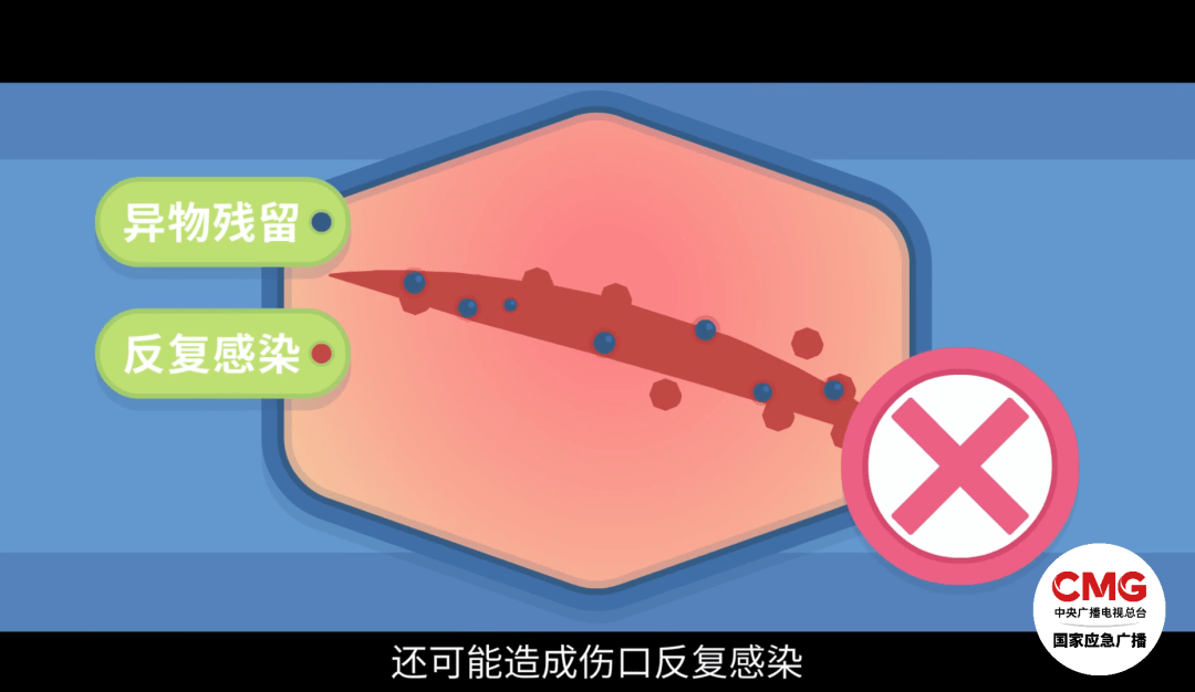洗澡时突然爆炸，女子手筋断裂，多处缝针……家里有它快自查