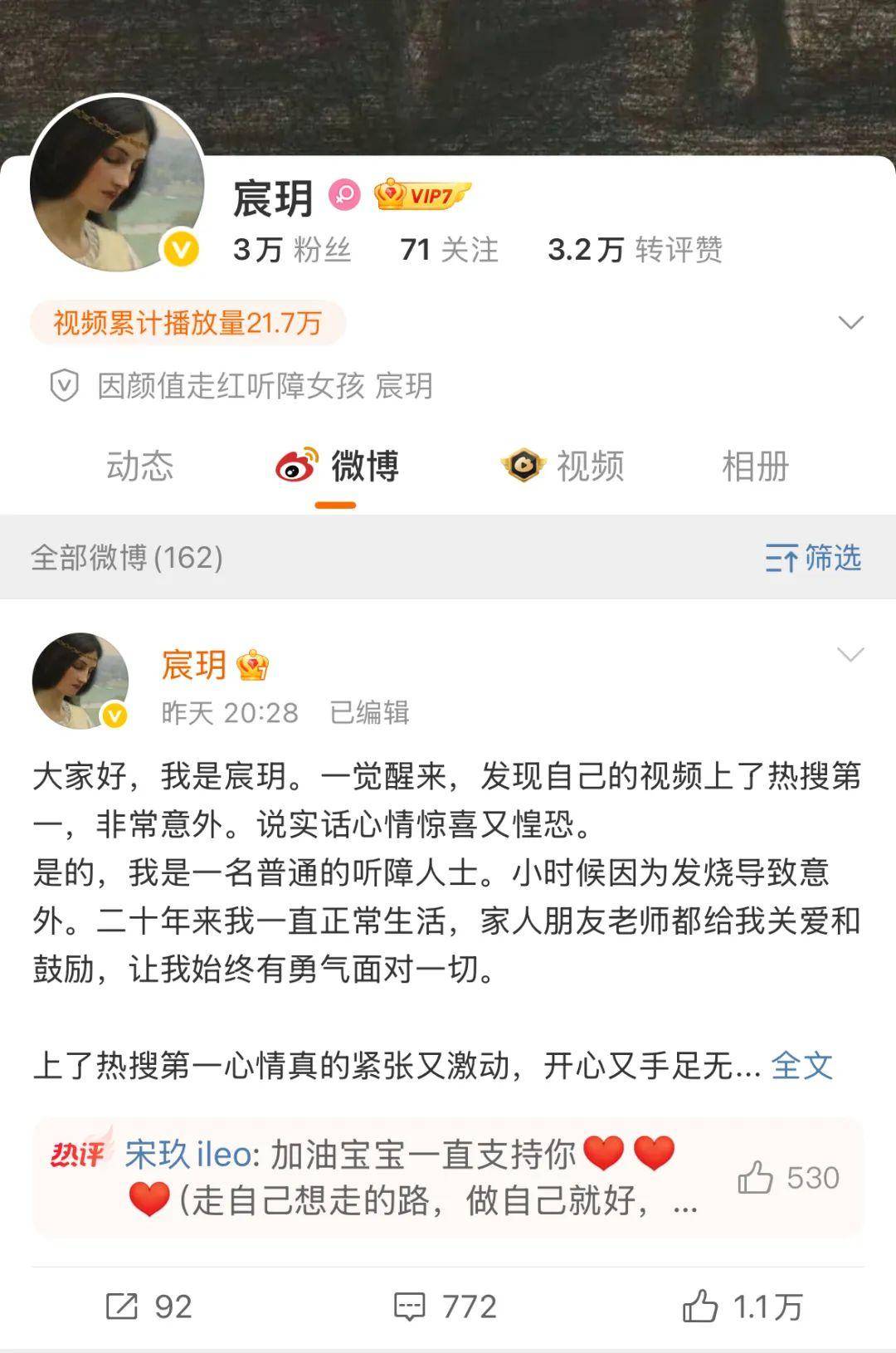 听障女生因“长相完美”走红，背后MCN机构曝光