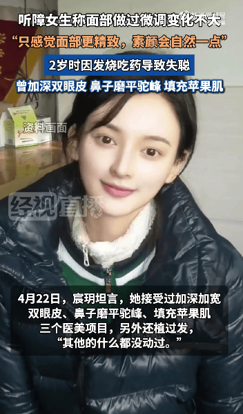“美院聋哑女生因长相太完美”登热搜第一，本人承认微调：不太上镜，比照片视频好看